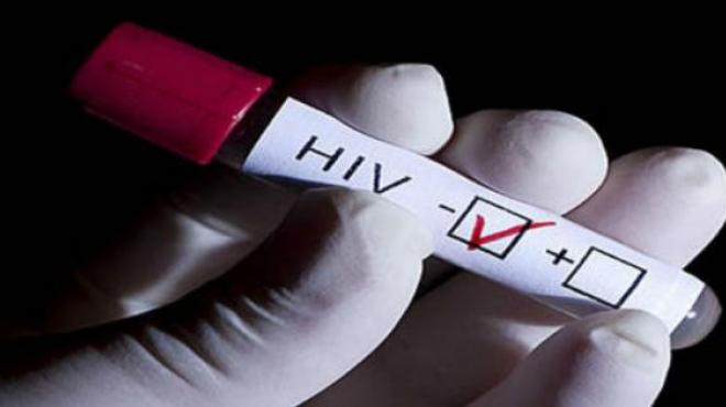 Jalisco registra 54 casos de VIH al mes