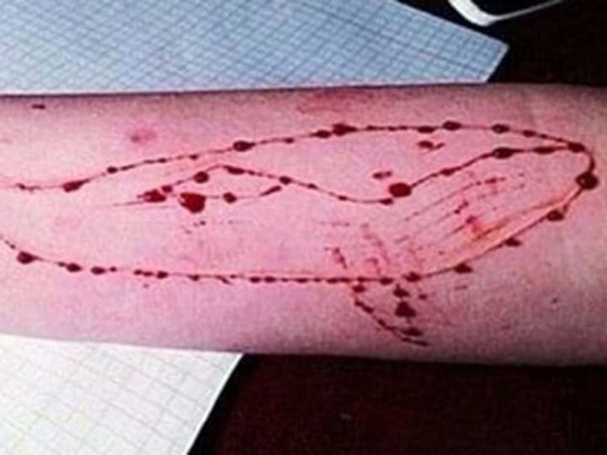 Se suicida adolescente por jugar reto de la ‘ballena azul’