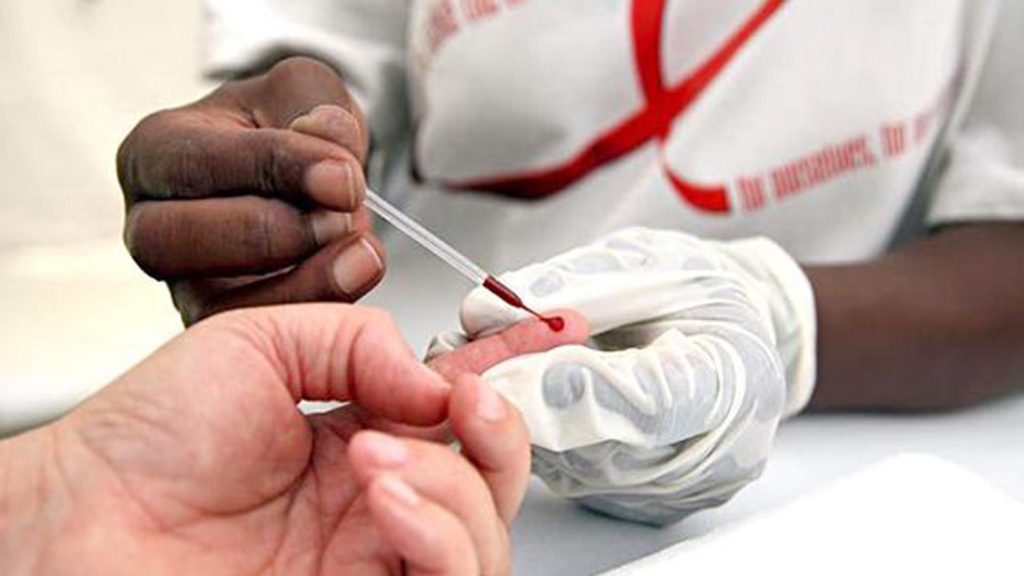 Seguro Social advierte sobre posibles síntomas del VIH-Sida
