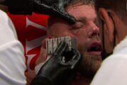 Billy Joe Saunders fue sometido a una sensible operación en el ojo tras las múltiples fracturas que sufrió por los golpes de Canelo Álvarez