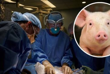 Trasplantan con éxito riñón de cerdo en paciente humano