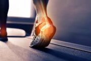 Coronavirus: Lesiones en los pies es el nuevo síntoma del Covid-19