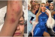Solicita esclarecimiento ante agresión policial contra artista drag internacional