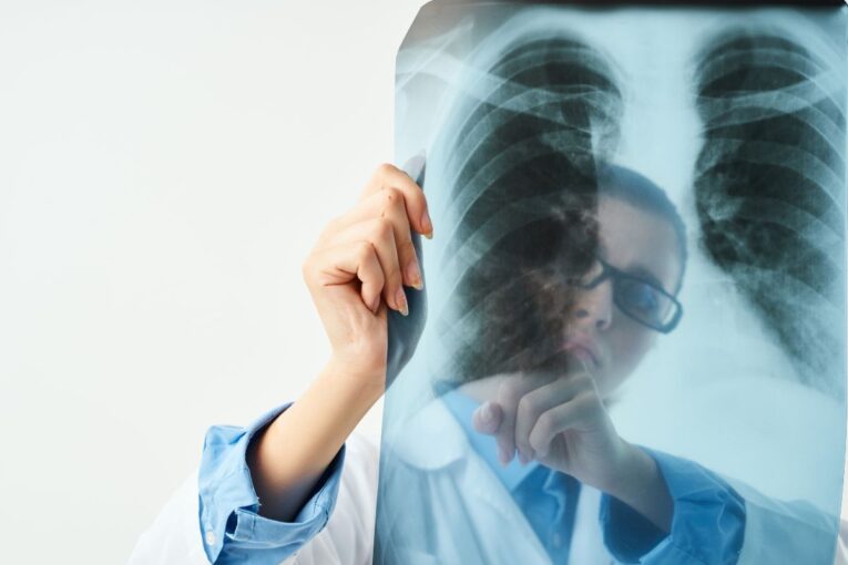 Radiografía a un pulmón humano
